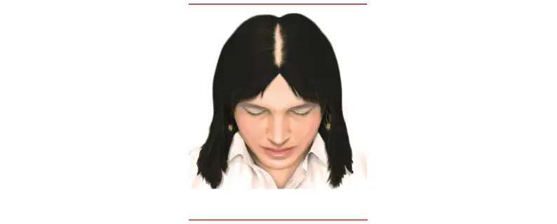 fillerina